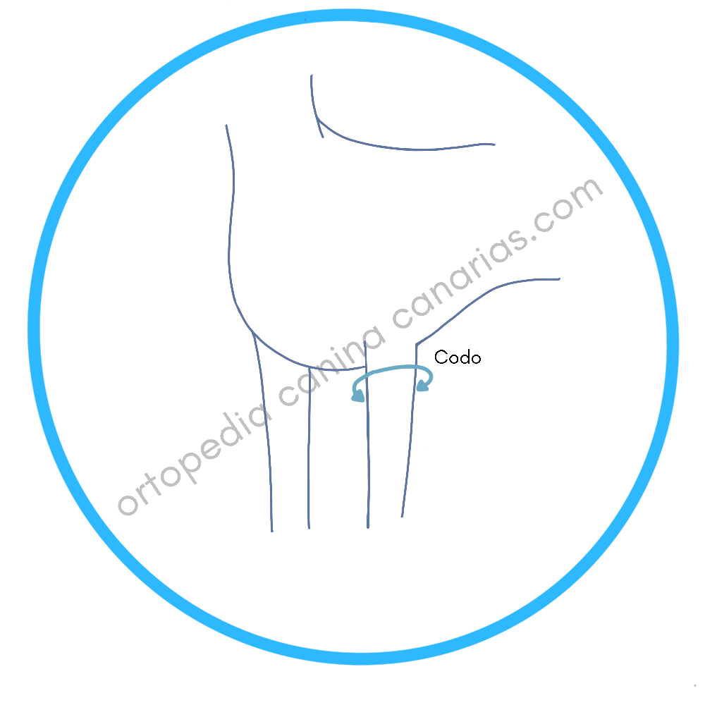 Medición de Ortesis de Codo