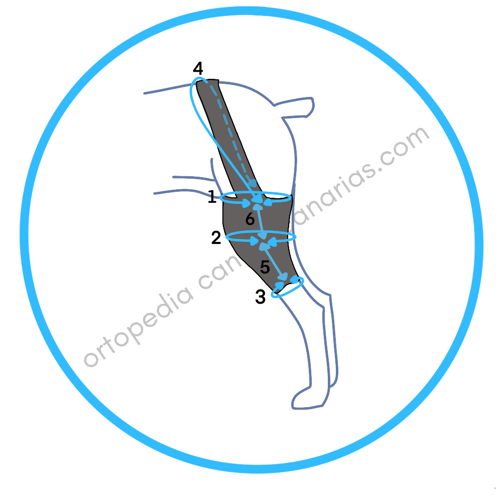 Protector de Rodilla a medida